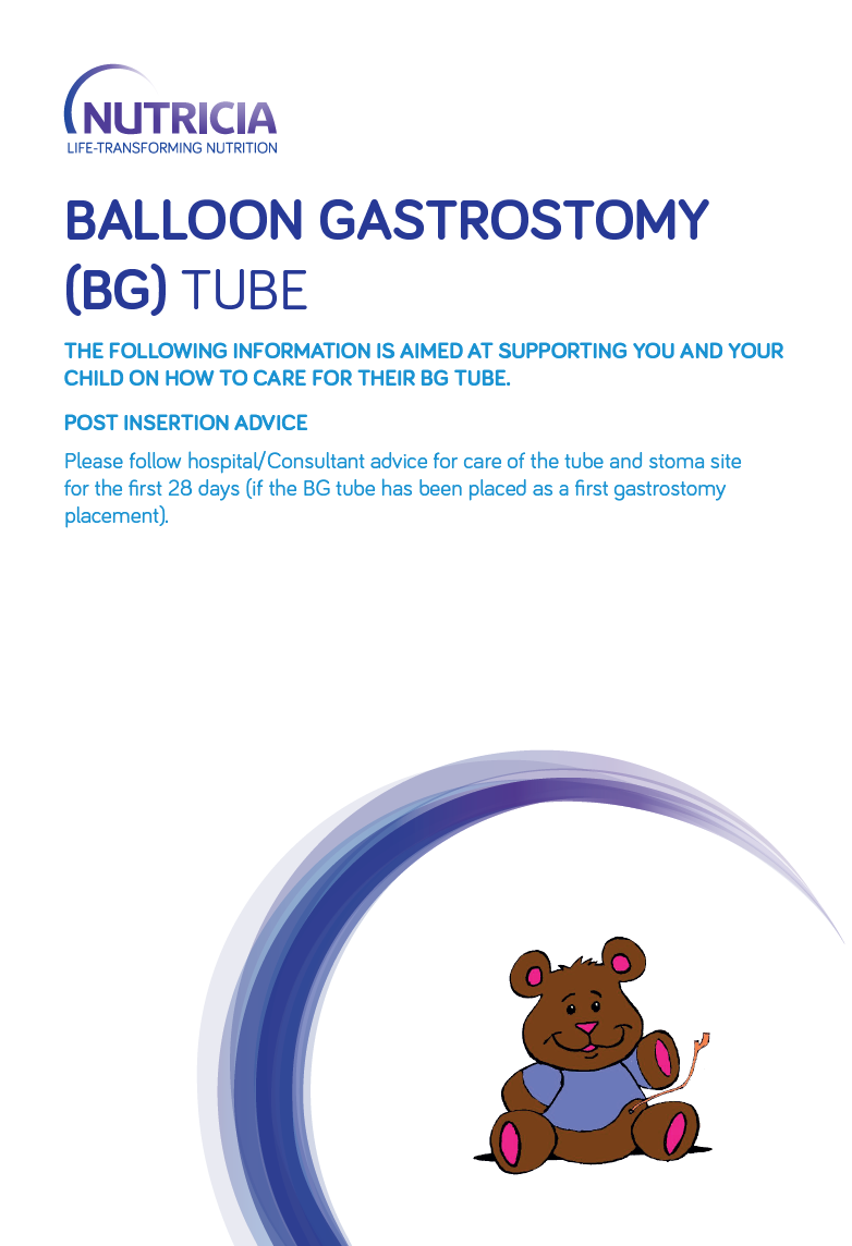 Balloon gastrostomy tube feeding paediatric - advice sheet