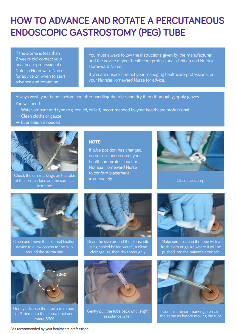 How to advance and rotate a PEG