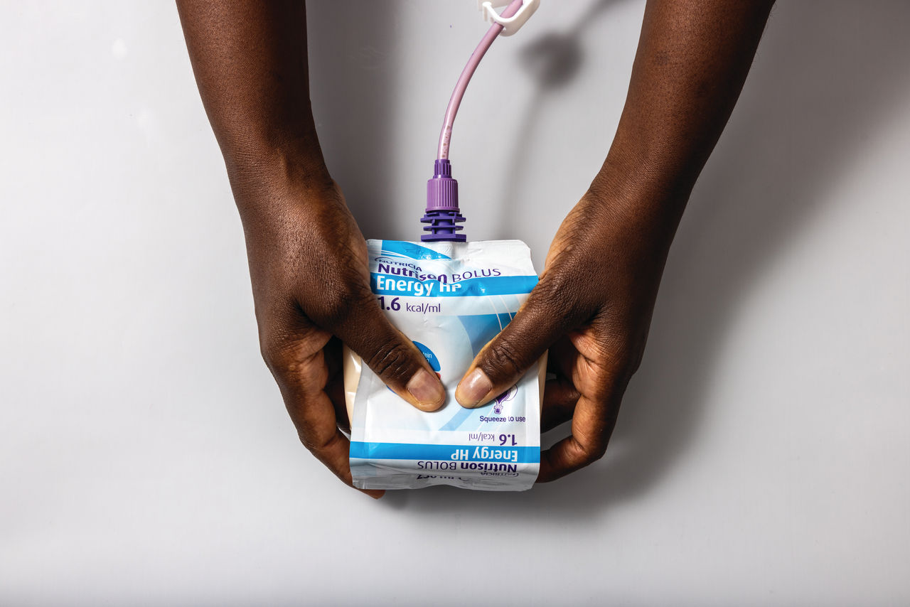 Demonstration image of squeezing Nutrison Bolus Energy HP 
