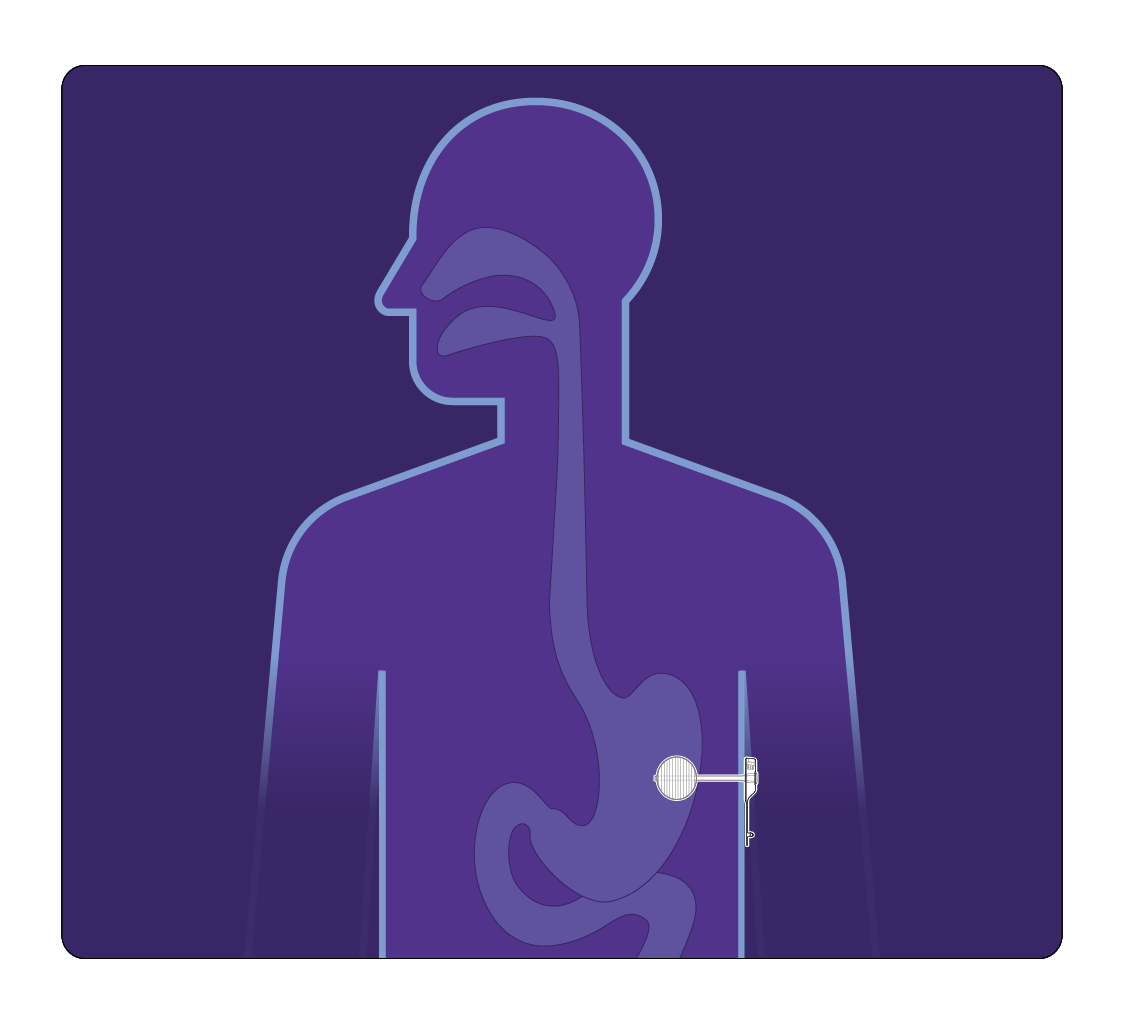 Nutricia tube feeding icon