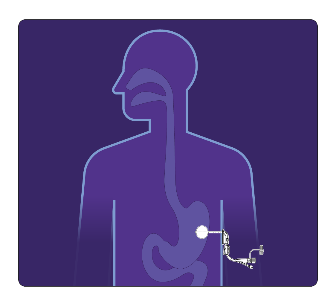 Nutricia tube feeding icon