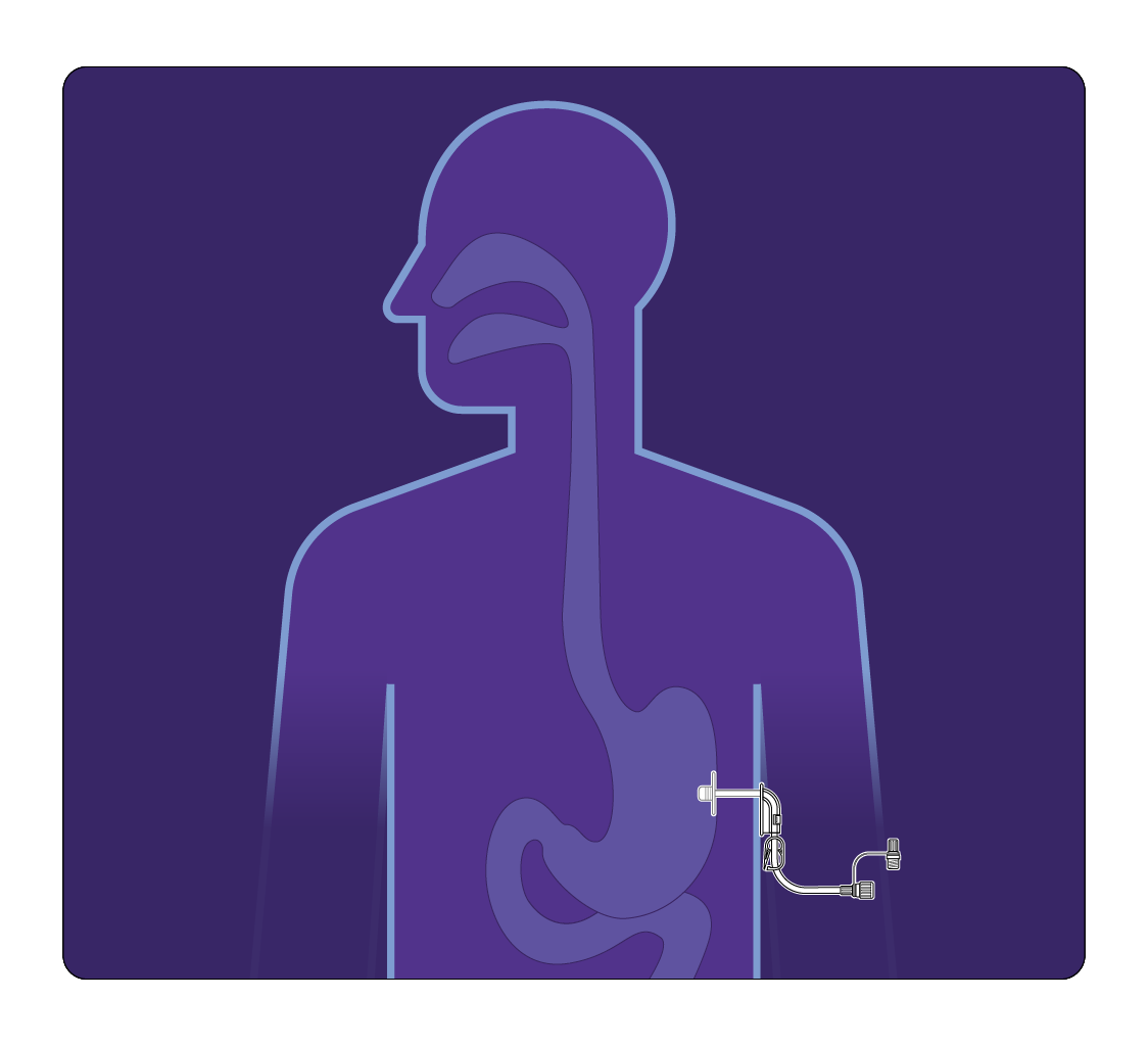 Nutricia tube feeding icon